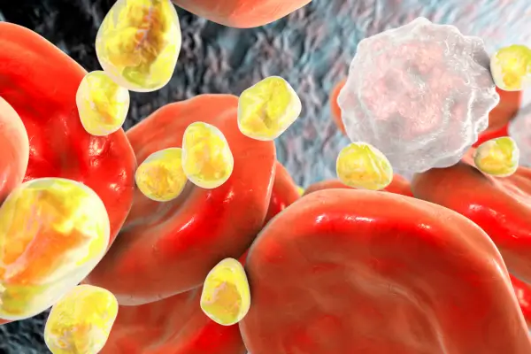 Você sabia que o colesterol total alto é responsável por 1 em cada 4 mortes por doenças cardiovasculares: Veja como resolver isso agora!